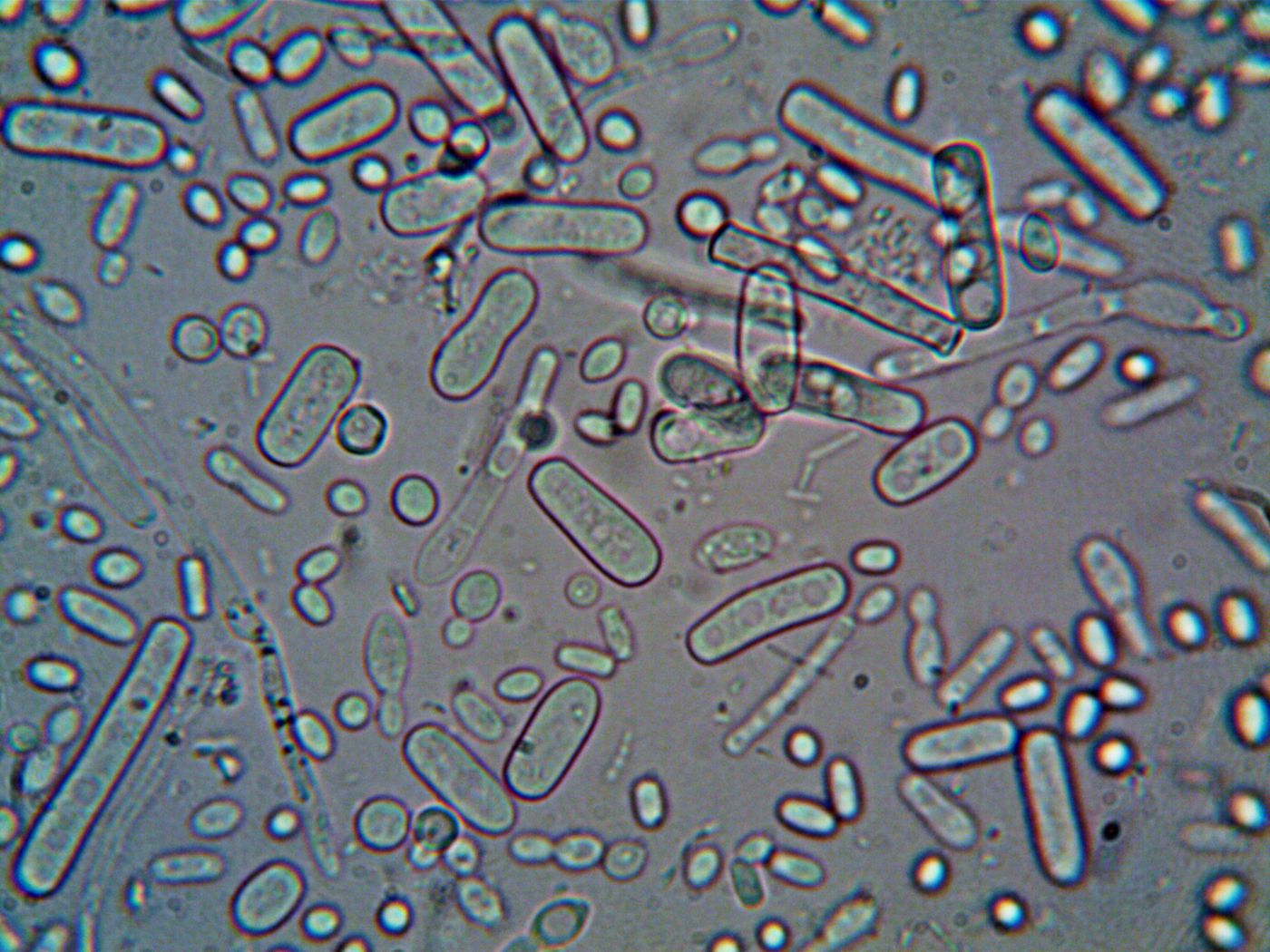 Rod-shaped bacteria viewed through a microscope